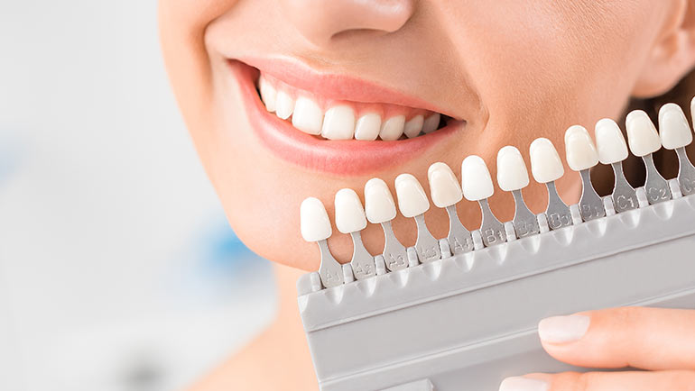 Teeth Whitening in Southern Illinois at Steele Dental