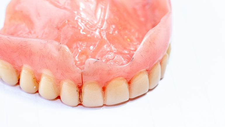 Denture or Partial Relines in Southern Illinois at Steele Dental in Pinckneyville, Illinois